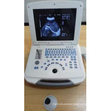 2D portable ultrasound machine and ultrasound scanner laptop